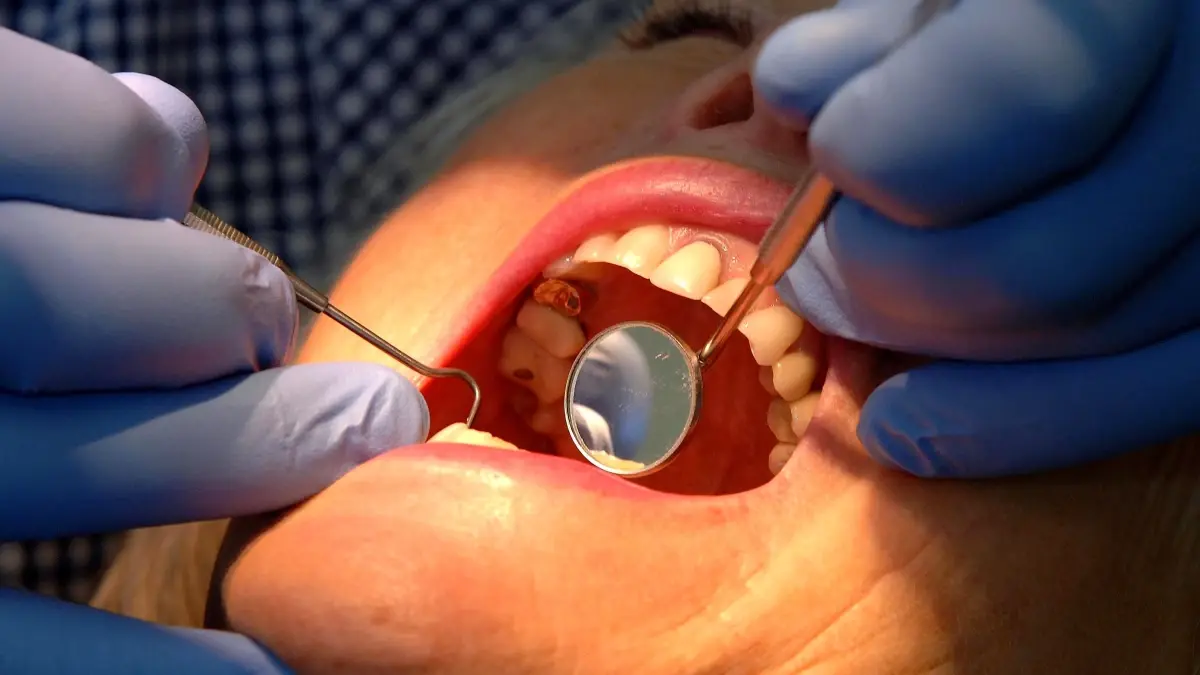 Nottingham Üniversitesi’nden Diş Minesini Yenileyen Yeni Jel Geliştirildi