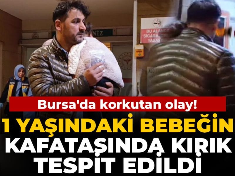 1 Yaşındaki Bebekte Kafatası Kırığı Tespit Edildi